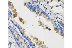 Immunohistochemistry of paraffin-embedded Mouse lung using IL36G Polyclonal Antibody at dilution of 1:100 (40x lens). (IL1F9 抗体)