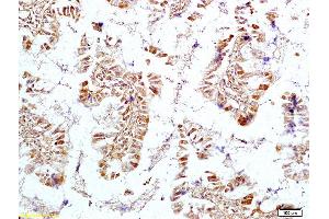 Formalin-fixed and paraffin embedded rat intestine tissue labeled with Anti OTC Polyclonal Antibody, Unconjugated (ABIN720505) at 1:200 followed by conjugation to the secondary antibody and DAB staining (OTC 抗体  (AA 51-150))