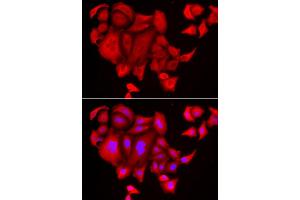Immunofluorescence analysis of HeLa cell using SLC26A2 antibody. (SLC26A2 抗体)