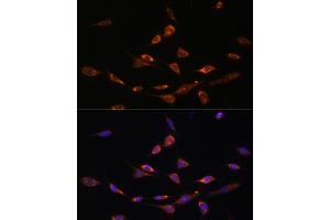Immunofluorescence analysis of NIH-3T3 cells using P antibody (ABIN7269162) at dilution of 1:100. (PAK3 抗体  (AA 1-100))
