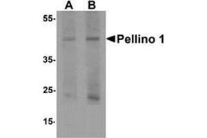 Western blot analysis of Pellino 1 in human liver tissue lysate with Pellino 1 Antibody  at (A) 1 and (B) 2 μg/ml. (Pellino 1 抗体  (C-Term))