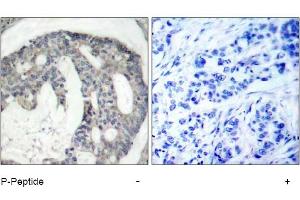 Image no. 1 for anti-Nitric Oxide Synthase 3 (Endothelial Cell) (NOS3) (pSer1177) antibody (ABIN319232) (ENOS 抗体  (pSer1177))