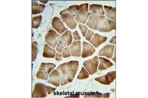 Formalin-fixed and paraffin-embedded human skeletal muscle reacted with COQ3 Antibody (Center), which was peroxidase-conjugated to the secondary antibody, followed by DAB staining. (COQ3 抗体  (AA 172-201))