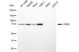Western blotting analysis using PFKP antibody (ABIN7799802). (PFKP 抗体)
