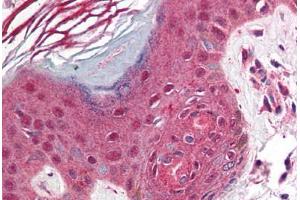 Human Skin (formalin-fixed, paraffin-embedded) stained with PDCD1 antibody ABIN214464 at 2. (PD-1 抗体  (C-Term))