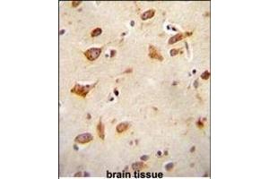 Immunohistochemistry (Paraffin-embedded Sections) (IHC (p)) image for anti-GDNF Family Receptor alpha Like (GFRAL) (AA 366-394), (C-Term) antibody (ABIN655021)