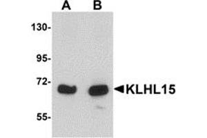 Western Blotting (WB) image for anti-Kelch-Like 15 (KLHL15) (C-Term) antibody (ABIN1030470) (KLHL15 抗体  (C-Term))