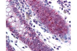Anti-SF1 antibody IHC of human colon. (Splicing Factor 1 抗体  (AA 517-566))