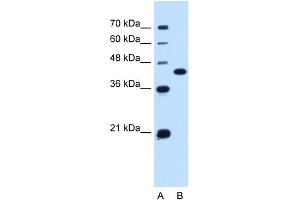 Western Blotting (WB) image for anti-Solute Carrier Family 14 (Urea Transporter), Member 1 (Kidd Blood Group) (SLC14A1) (C-Term) antibody (ABIN2783225)