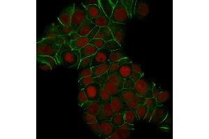 Confocal Immunofluorescence of MCF-7 cells E-Cadherin Mouse Monoclonal Antibody (CDH1/1525). (E-cadherin 抗体)