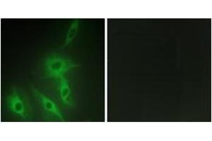 Immunofluorescence analysis of HeLa cells, using AS250 Antibody. (RALGAPA2 抗体  (AA 641-690))