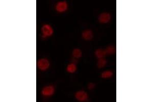 ABIN6274221 staining 293 cells by IF/ICC. (MZF1 抗体  (N-Term))