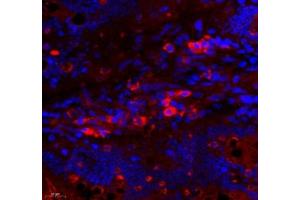Immunofluorescence (Paraffin-embedded Sections) (IF (p)) image for anti-rho GTPase Activating Protein 18 (ARHGAP18) antibody (ABIN7075417)