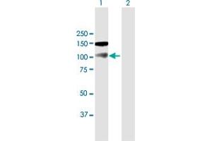 Western Blot analysis of NBR1 expression in transfected 293T cell line by NBR1 MaxPab polyclonal antibody. (NBR1 抗体  (AA 1-966))