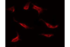 ABIN6269245 staining Hela by IF/ICC. (STAT1 抗体)