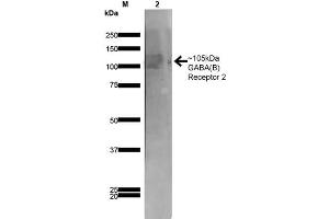 Western Blot analysis of Rat Brain Membrane showing detection of ~105 kDa GABA B Receptor 2 protein using Mouse Anti-GABA B Receptor 2 Monoclonal Antibody, Clone S81-2 . (GABBR2 抗体  (AA 861-912))