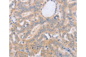 Immunohistochemistry (IHC) image for anti-Bone Marrow Stromal Cell Antigen 1 (BST1) antibody (ABIN2432738) (BST1 抗体)