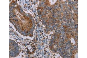 Immunohistochemistry (IHC) image for anti-Cytochrome P450, Family 7, Subfamily A, Polypeptide 1 (CYP7A1) antibody (ABIN2435000) (CYP7A1 抗体)