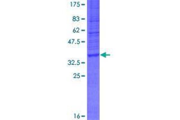 WDR82 Protein (AA 1-137) (GST tag)