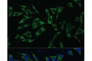 Immunofluorescence analysis of L929 cells using Polyclonal AntibodyPC1 Polyclonal Antibody at dilution of 1:100 (40x lens). (PC1 抗体)