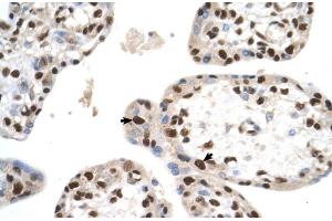 SETD2 antibody - N-terminal region  validated by IHC using Human Placenta lysate at 4. (SETD2 抗体  (N-Term))
