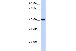 WB Suggested Anti-IRX6 Antibody Titration:  0. (IRX6 抗体  (N-Term))