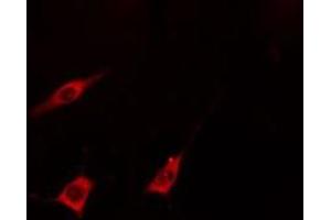 Immunofluorescence (fixed cells) (IF/ICC) image for anti-Potassium Voltage-Gated Channel, Shaker-Related Subfamily, Member 5 (KCNA5) (Internal Region) antibody (ABIN6257764)