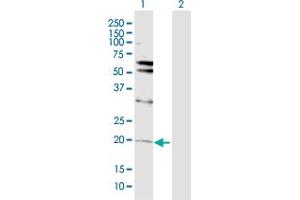 Western Blot analysis of VHL expression in transfected 293T cell line by VHL MaxPab polyclonal antibody. (VHL 抗体  (AA 1-172))