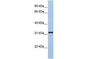 WB Suggested Anti-SLC25A28 Antibody Titration:  1 ug/ml  Positive Control:  MCF-7 whole cell lysates (SLC25A28 抗体  (C-Term))
