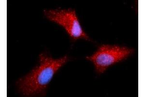 Immunofluorescence (IF) image for anti-Complexin 1 (CPLX1) (AA 1-134) antibody (APC) (ABIN5565317) (Complexin 1 抗体  (AA 1-134) (APC))