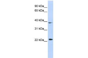 WB Suggested Anti-PRR11 Antibody Titration:  0. (PRR11 抗体  (Middle Region))