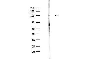 Western blot analysis of lysates from PC12 cells(UV,30 min treatment), using HIRA Antibody at 1/1000 dilution.