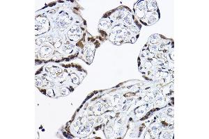 Immunohistochemistry of paraffin-embedded human placenta using [KO Validated] PDCD4 Rabbit pAb (ABIN3023387, ABIN3023388, ABIN3023389 and ABIN1681284) at dilution of 1:25 (40x lens). (PDCD4 抗体  (AA 1-260))