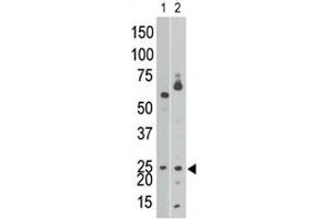 The BNIP3 antibody western blot analysis of Ramos cell lysate (lane 1) and in mouse brain tissue lysate (2). (BNIP3 抗体  (AA 152-187))