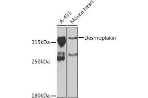 Western blot analysis of extracts of various cell lines, using Desmoplakin antibody (ABIN6134106, ABIN6139838, ABIN6139840 and ABIN6223548) at 1:1000 dilution. (Desmoplakin 抗体  (AA 1-100))