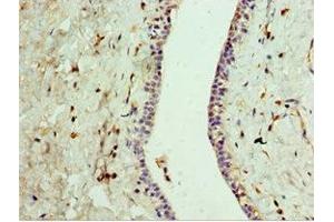 Immunohistochemistry (IHC) image for anti-G Protein-Coupled Receptor, Family C, Group 5, Member A (GPRC5A) (AA 258-357) antibody (ABIN7167823)