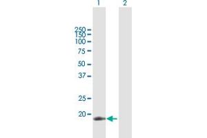 Western Blotting (WB) image for anti-Apolipoprotein B mRNA Editing Enzyme, Catalytic Polypeptide-Like 3C (APOBEC3C) (AA 1-190) antibody (ABIN949220)