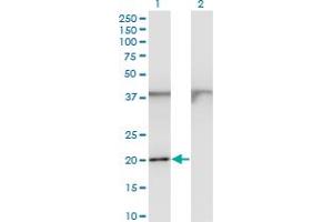 Western Blot analysis of FTL expression in transfected 293T cell line by FTL monoclonal antibody (M15), clone 1C14. (FTL 抗体  (AA 1-175))