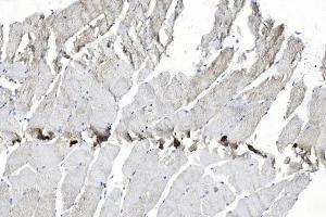 Immunohistochemical analysis of paraffin-embedded Human Skeletal muscle section using Pink1 am7623b. (EPH Receptor B2 抗体)