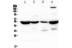 Western blot analysis of Adenylosuccinate Lyase using anti-Adenylosuccinate Lyase antibody . (ASL 抗体)