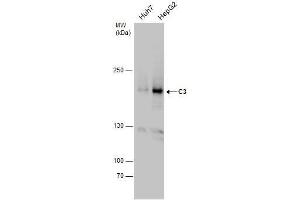 WB Image C3 antibody detects C3 protein by western blot analysis. (C3 抗体  (C-Term))
