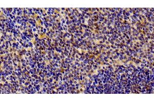 Detection of STAT6 in Rat Spleen Tissue using Polyclonal Antibody to Signal Transducer And Activator Of Transcription 6 (STAT6) (STAT6 抗体  (AA 557-841))
