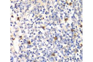 Immunohistochemistry of paraffin-embedded Mouse spleen using PSMD7 Polyclonal Antibody at dilution of 1:100 (40x lens). (PSMD7 抗体)