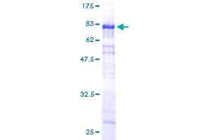 Image no. 1 for Sorting Nexin 25 (SNX25) (AA 1-483) protein (GST tag) (ABIN1320889) (SNX25 Protein (AA 1-483) (GST tag))