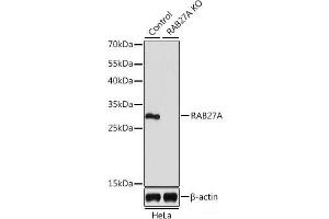 Western blot analysis of extracts from normal (control) and RAB27A knockout (KO) HeLa cells using RAB27A Polyclonal Antibody at dilution of 1:1000. (RAB27A 抗体)