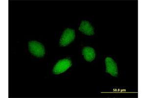 Immunofluorescence of purified MaxPab antibody to RHOXF1 on HeLa cell. (RHOXF1 抗体  (AA 1-184))