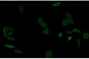 Detection of aZGP1 in Human MCF7 cell using Monoclonal Antibody to Alpha-2-Glycoprotein 1, Zinc Binding (aZGP1) (AZGP1 抗体  (AA 18-296))
