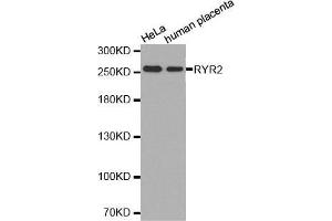 Western Blotting (WB) image for anti-Ryanodine Receptor 2 (Cardiac) (RYR2) (AA 4850-4950) antibody (ABIN6213787) (RYR2 抗体  (AA 4850-4950))
