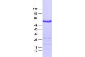 Western Blotting (WB) image for ELK4, ETS-Domain Protein (SRF Accessory Protein 1) (ELK4) protein (His tag) (ABIN2720141)