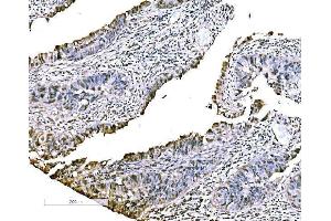 IHC analysis of CBX2 using anti-CBX2 antibody (ABIN7599466).